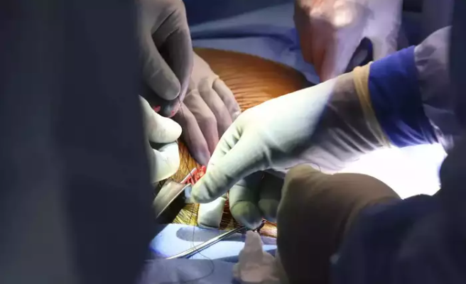 चिकित्सकीय क्षेत्रमा ठूलो चमत्कार, पहिलोपटक जीवित मानिसमा सुँगुरको मिर्गौला प्रत्यारोपण